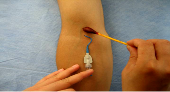 picc如何更换敷贴视频家庭picc换药方法